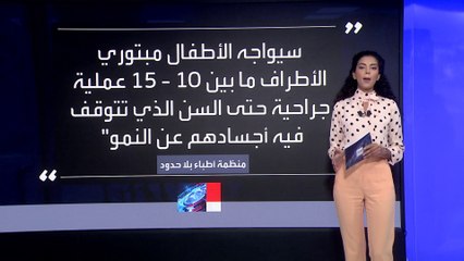 طبيب فلسطيني: أجريت 6 عمليات بتر أطراف في ليلة واحدة وبعضها دون تخدير