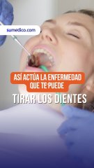 Así actúa la enfermedad que te puede tirar los dientes
