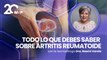 Todo sobre Artritis reumatoide: diagnóstico temprano con una reumatóloga - #ExclusivoMSP
