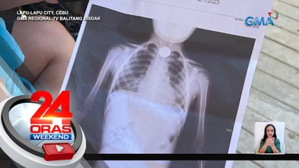 4-anyos na batang lalaki sa Cebu, nakalunok ng P5 barya | 24 Oras Weekend