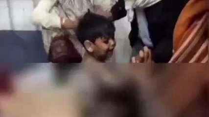 बयाना: खेल-खेल में मासूम गिरा गर्म चाय के बर्तन में, गंभीर हालत में किया भर्ती