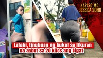 Lalaki, tinubuan ng bukol sa likuran na aabot sa 20 kilos ang bigat | Kapuso Mo Jessica Soho