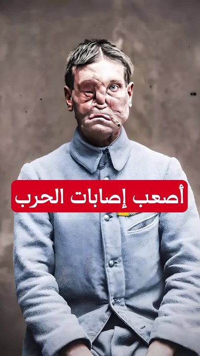 ما هى أصعب الإصابات فى الحرب العالمية#shorts
