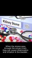 5 Symptoms and Signs of Kidney Stones