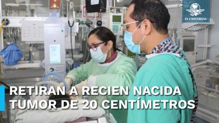 Para presumir; IMSS retira un tumor embrionario a recién nacida y le salva la vida