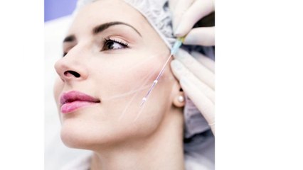 Non Surgical Thread Lift  Mohali  Chandiagrh