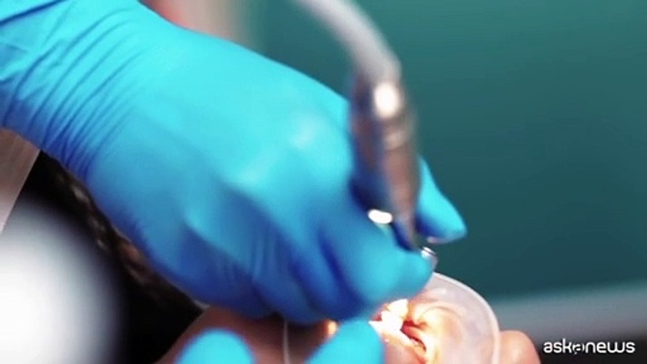 Odontoiatria, rivoluzione "Bocca Bionica"