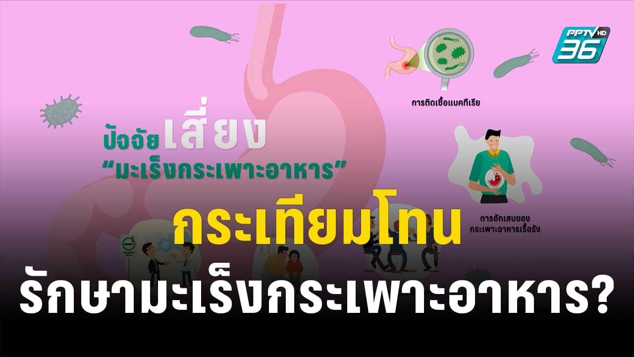 1 นาทีสุขภาพดี กับ BDMS ตอน กระเทียมโทนรักษามะเร็งกระเพาะอาหาร? | โชว์ข่าวเช้านี้ | 6 ธ.ค. 66