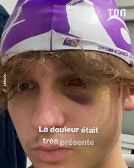 Son opération des dents de sagesse ne se passe pas comme prévu