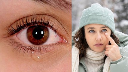 सर्दी में आँखों से पानी क्यों आता है | Watery Eyes In Winter Reason In Hindi| Boldsky