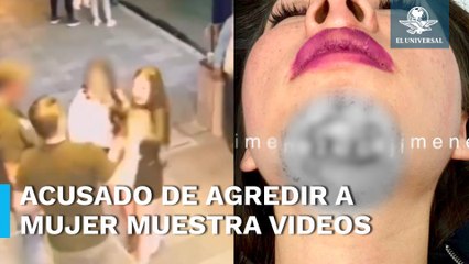 Hombre acusado de golpear a mujer afuera del antro Bombay da su versión de los hechos