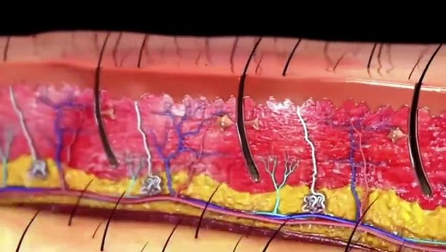 How to Get Rid of Hyper pigmentation (Aging or Dark Spots)