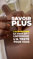 L'acupuncture ça vous dit ? Linfodrome l'a testé pour vous #short