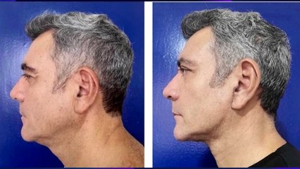 dbb-hectorsandarti-071223