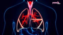 Beyaz Akciğer Sendromu nedir ve belirtileri nelerdir? Beyaz Akciğer Sendromu tedavisi nedir?