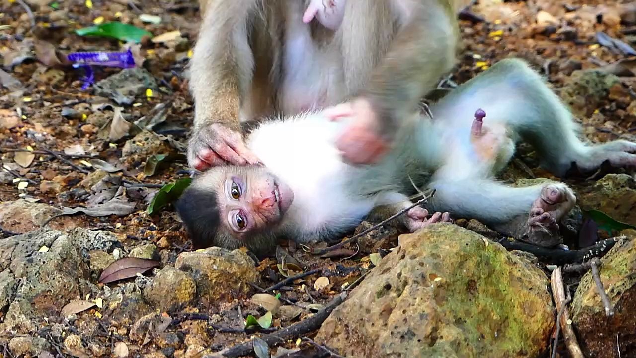 Little Sada baby feel high hurt, because eye reaction, after accidence happen, Sabe treat carefully (720p_25fps_H264-192kbit_AAC)