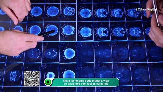Nova tecnologia pode mudar a vida de pacientes com lesões cerebrais
