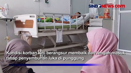 Jalani Pemulihan Luka, Korban Erupsi Gunung Marapi Masih Dirawat