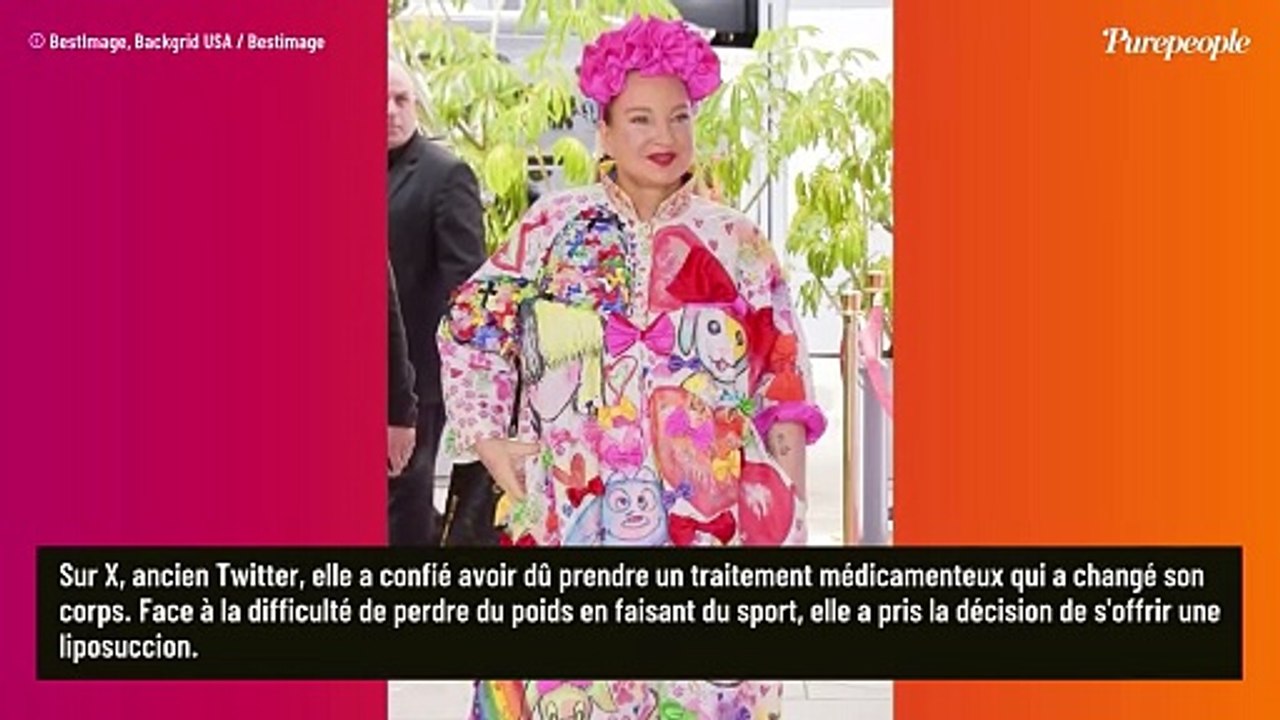 La chanteuse Sia évoque sans tabou sa dernière liposuccion : "Je veux être honnête sur toutes mes interventions"