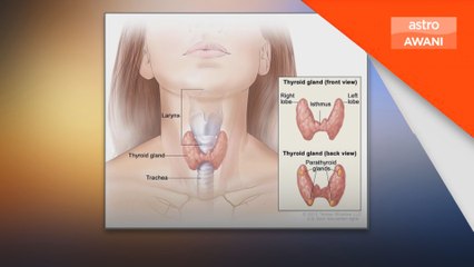 Masyarakat perlu cakna dengan gangguan tiroid dalam tubuh