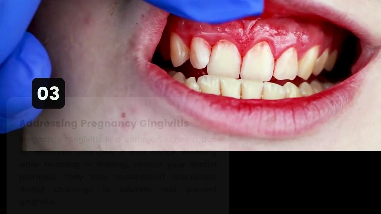 Pregnancy Glow: Nurturing Your Smile Through Every Trimester