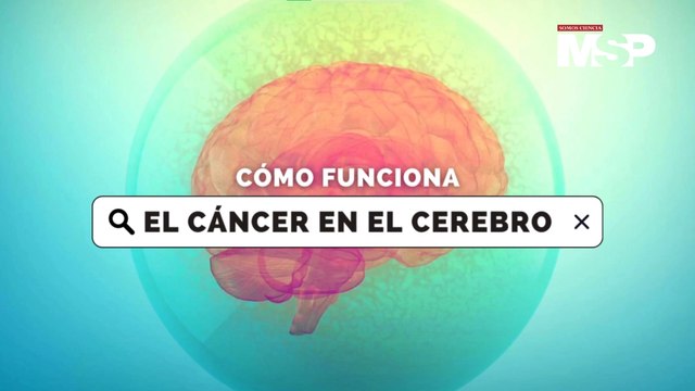 ¿Cómo funciona el cáncer en el cerebro?
