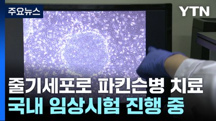 줄기세포로 파킨슨병 근본 치료...임상시험 진행 중 / YTN
