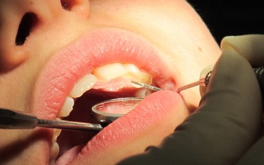 VIH : 1145 patients invités à se faire dépister à cause d'un dentiste de Cherbourg