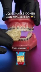 What to eat with brackets in laser dentistry