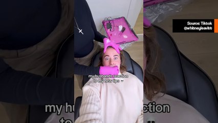 Hauska video: TikToker jakaa esteettisen toimenpiteen, joka jätti hänet valtavilla huulilla ja huvittaa nettiyleisöä