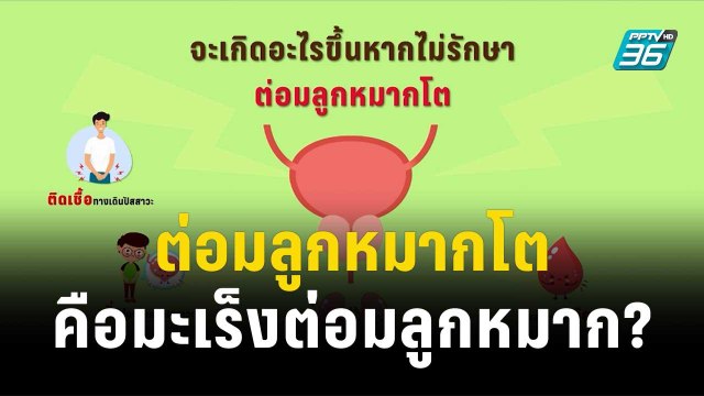 นาทีสุขภาพดี กับ BDMS EP9 ต่อมลูกหมากโตคือมะเร็งต่อมลูกหมาก? | โชว์ข่าวเช้านี้ | 15 ธ.ค. 66