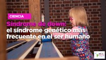 Síndrome de down: el síndrome genético más frecuente en el ser humanSíndrome de down: el síndrome genético más frecuente en el ser humano