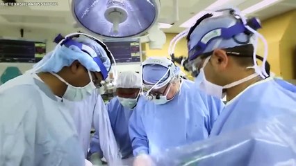 ⁴⁷ Personas Únicas A Las Que Les Faltan Partes Del Cuerpo