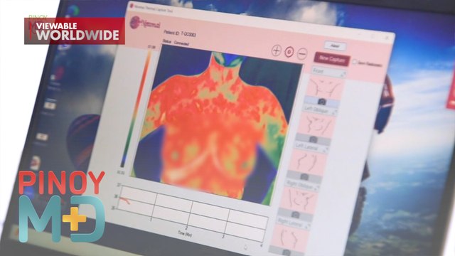 'Thermalytix,' puwedeng makapagdetect ng breast cancer sa pinakamabilis at pinakamurang halaga! | Pinoy MD