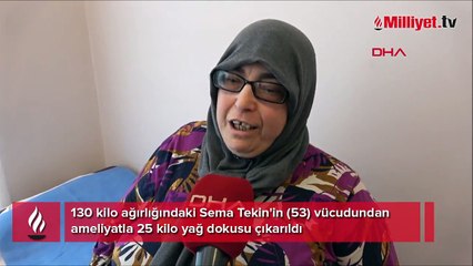 Hareket etmekte güçlük çekiyordu! Vücudundan 25 kiloluk yağ dokusu çıkarıldı
