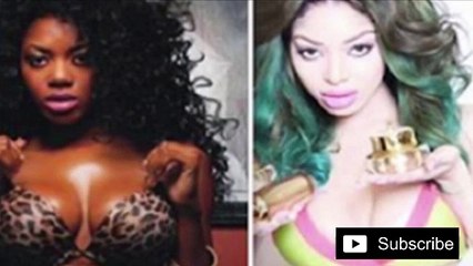 Skin Bleaching Addiction Before & After