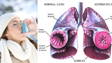 सर्दी में अस्थमा क्यों बढ़ जाता है | Winter Asthma Attack Reason In Hindi | Boldsky