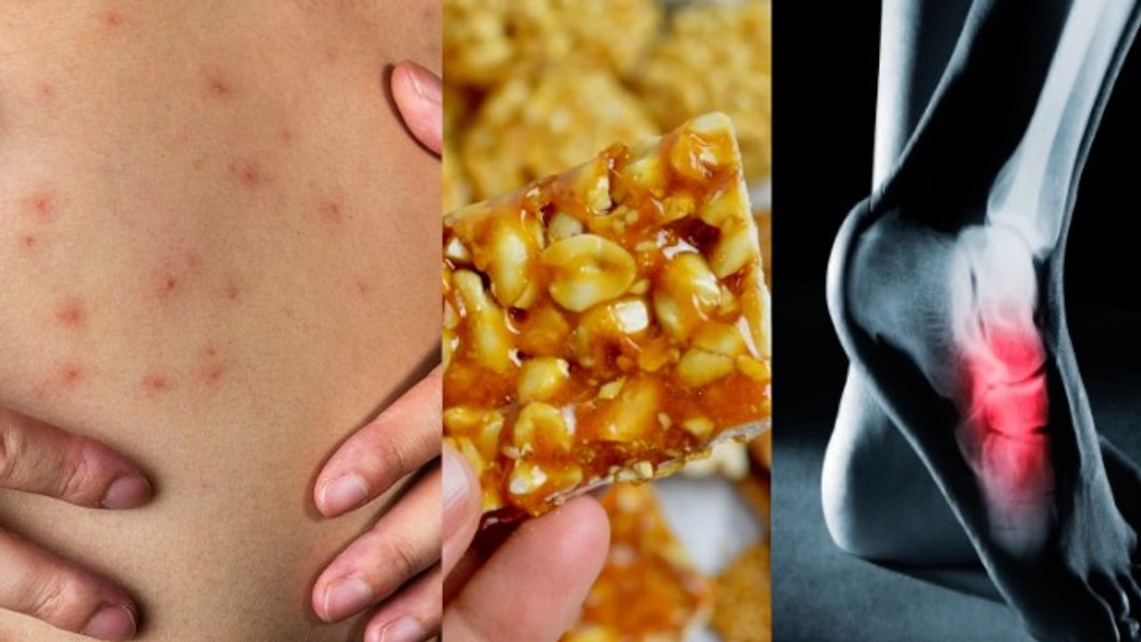 Gud Ki Chikki Khane Ke Fayde, Hemoglobin से लेकर Bone Strong में Beneficial | Boldsky