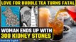 Taiwan woman replaces drinking water with bubble tea, ends up with 300 kidney stones | Oneindia News
