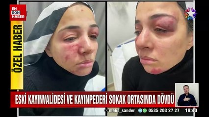 Eski kayınvalidesi ve kayınpederi sokak ortasında dövdü