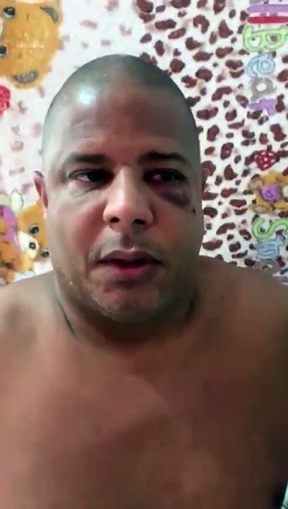 Com sinais de agressão, Marcelinho Carioca grava vídeo sobre sequestro