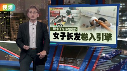 巴西17岁少女长发被卡丁车引擎卷入，80%头皮受伤😢