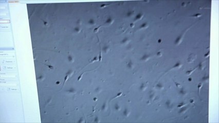 New Hormone-Free Male Contraceptive Enters First Human Trial