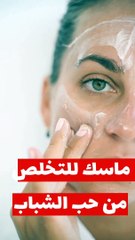 ماسك علاج حب الشباب _ طبيعي 100