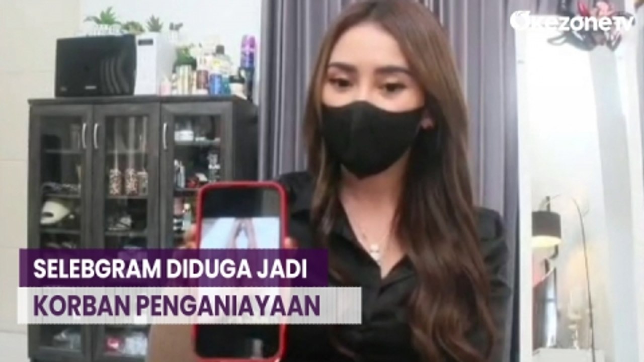 Cemburu, Selebgram asal Sidoarja Diduga Jadi Korban Penganiayaan Kekasihnya