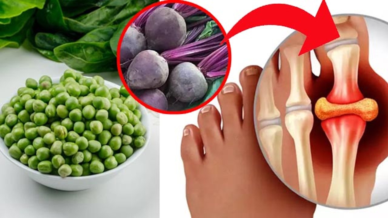 Sardi Me Uric Acid Badhne Par Kya Kare | Thand Me Uric Acid Kyu Badhta Hai | Boldsky