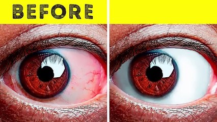 10+ Easy Exercises to Relieve Tired Eyes