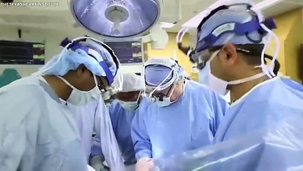 ⁴⁷ Personas Únicas A Las Que Les Faltan Partes Del Cuerpo