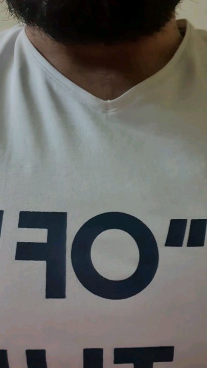 أكبر نتيجة بتاريخ كرة القدم 149-0