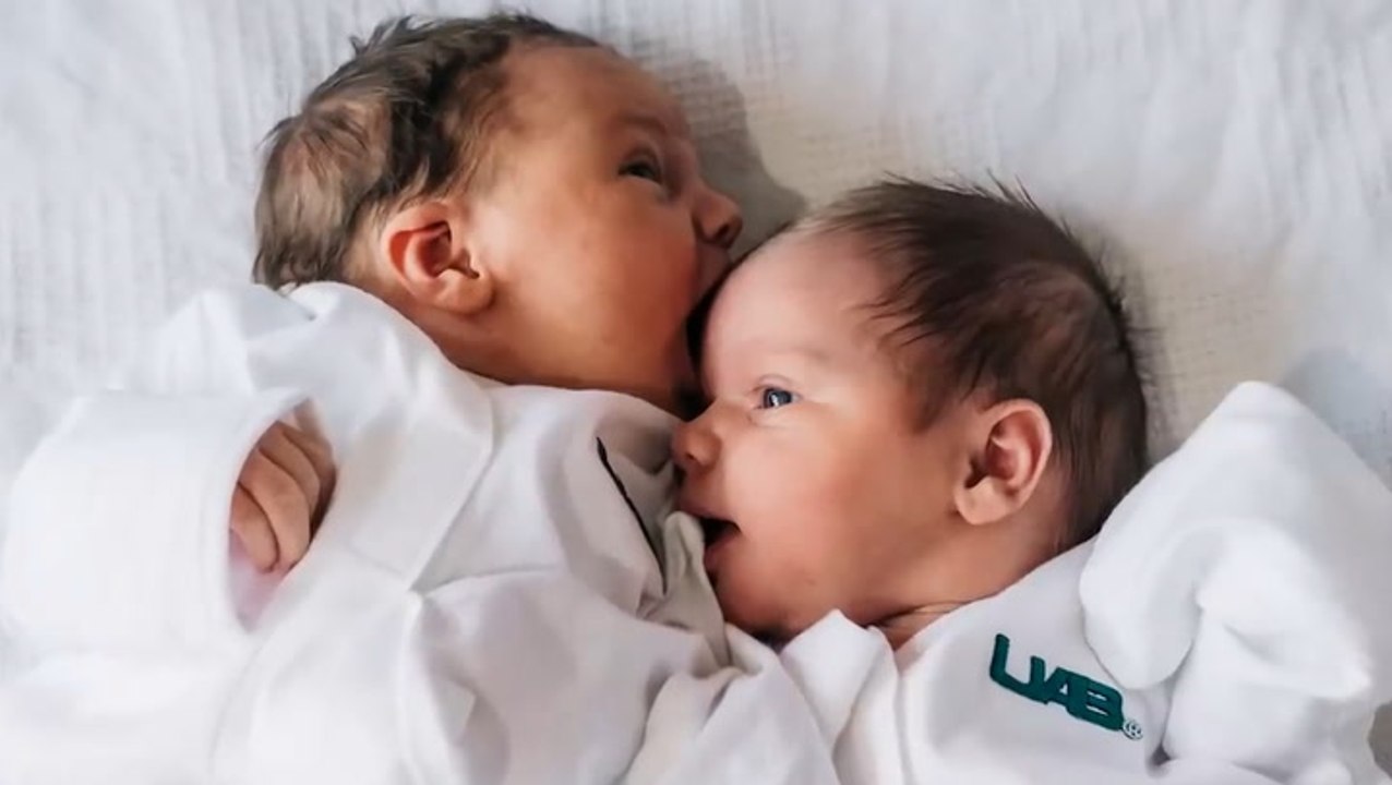 Watch: ‘One in a million’ babies born to mother with rare double womb